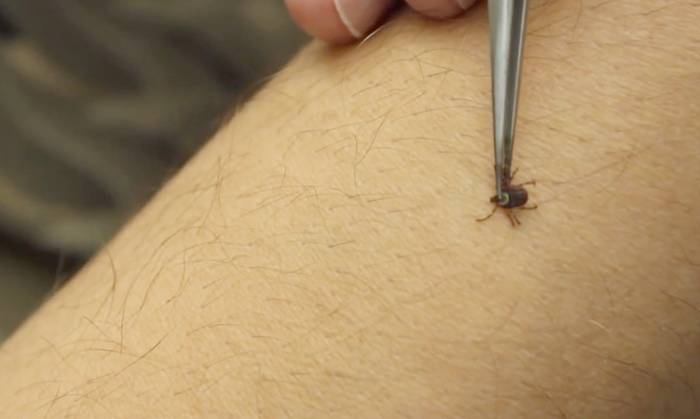 Lyme gaixotasunak eragindako ospitaleratzeak % 363 igo dira Nafarroan azkeneko 15 urteotan